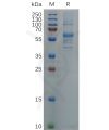 sp-pme100687 s protein rbd sp1