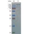 sp-pme100690 vwf sp1