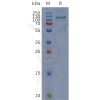 sp-pme100695 cd93 sp1