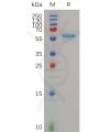 sp-pme100698 mmp13 sp1