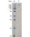 sp-pme100706 itga2 sp1