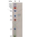 sp-pme100720 npc1l1 sp1
