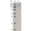 sp-pme100723 tem1 sp1
