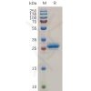 sp-pme100724 mesothelin sp1
