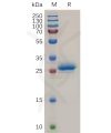 sp-pme100724 mesothelin sp1