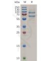 sp-pme100725 adam8 sp1