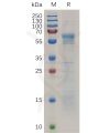 sp-pme100727 prnp sp1