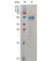 sp-pme100728 prnp sp1