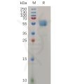 sp-pme100729 tmigd2 sp1