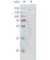sp-pme100742 adamts13 sp1