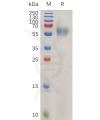 sp-pme100746 il1rap sp1