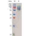 sp-pme100749 emcn sp1