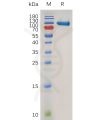 sp-pme100754 mmp9 sp1