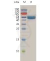 sp-pme100761 rnf43 sp1