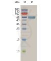 sp-pme100762 rnf43 sp1