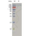 sp-pme100764 itgax itgb2 sp1
