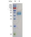 sp-pme100766 trop2 sp1