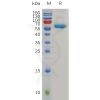 sp-pme100767 cd72 sp1