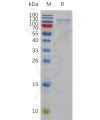 sp-pme100771 adamts1 sp1