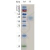 sp-pme100776 cd52 sp1