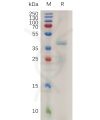 sp-pme100779 rspo1 sp1
