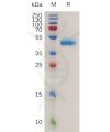sp-pme100780 rspo1 sp1