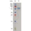 sp-pme100788 il18rap sp1