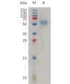 sp-pme100788 il18rap sp1