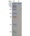 sp-pme100813 cd21 sp1
