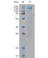 sp-pme100814 igf 1r sp1
