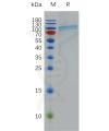 sp-pme100818 cd39 sp1