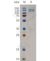 sp-pme100821 mst1r sp1