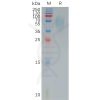 sp-pme100827 cd200r1 sp1