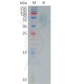sp-pme100827 cd200r1 sp1