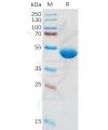 sp-pme100838 il1b sp1