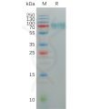 sp-pme100844 kir2dl2 sp1