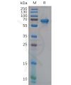 sp-pme100852 ncr1 sp1