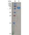 sp-pme100855 vsig4 sp1