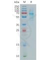 sp-pme100863 colec10 sp1