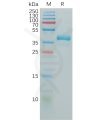 sp-pme100871 gnrhr sp1