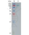 sp-pme100881 il12rb1 sp1