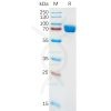 sp-pme100886 il1ra sp1