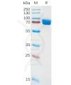 sp-pme100886 il1ra sp1
