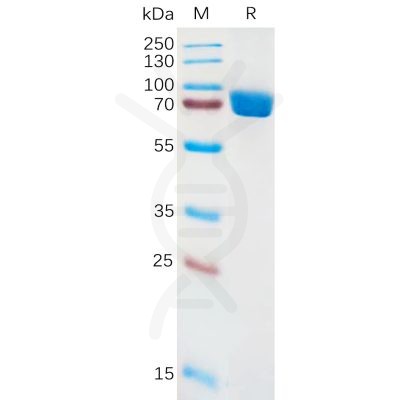 sp-pme100886 il1ra sp1