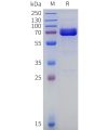 sp-pme100899 acpp sp1