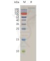 sp-pme100915 brd4 sp1
