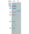 sp-pme100923 ccr5 sp1