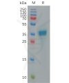 sp-pme100936 cxcl9 sp1