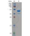sp-pme100937 cxcr2 sp1
