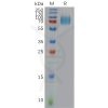 sp-pme100958 ifnar1 sp1